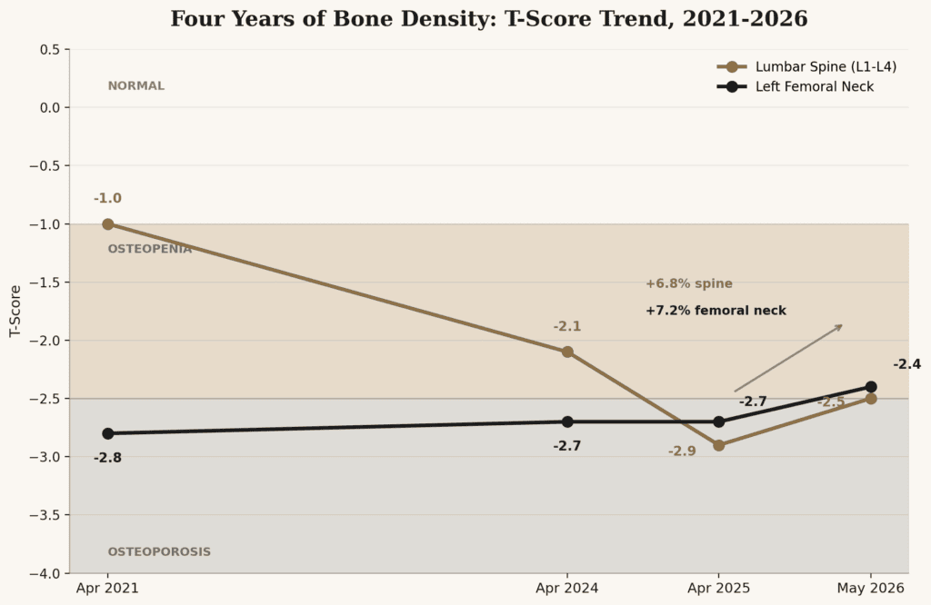 Bone density T-score trend from 2021 to 2026